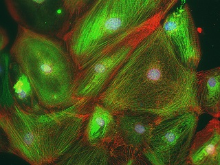 Heart cells created from stem cells