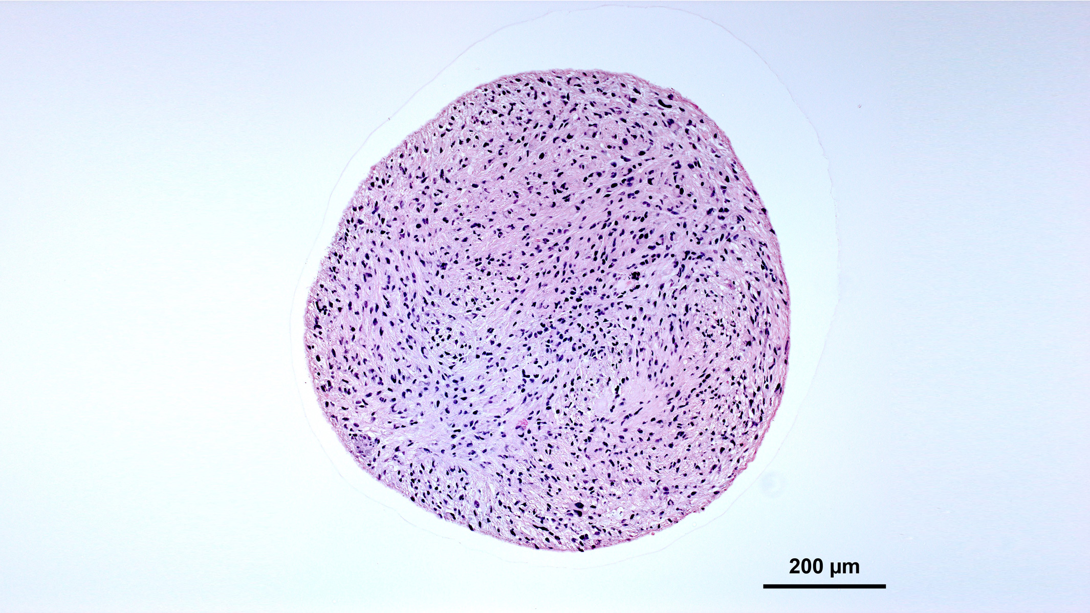 Hindbrain Organoid