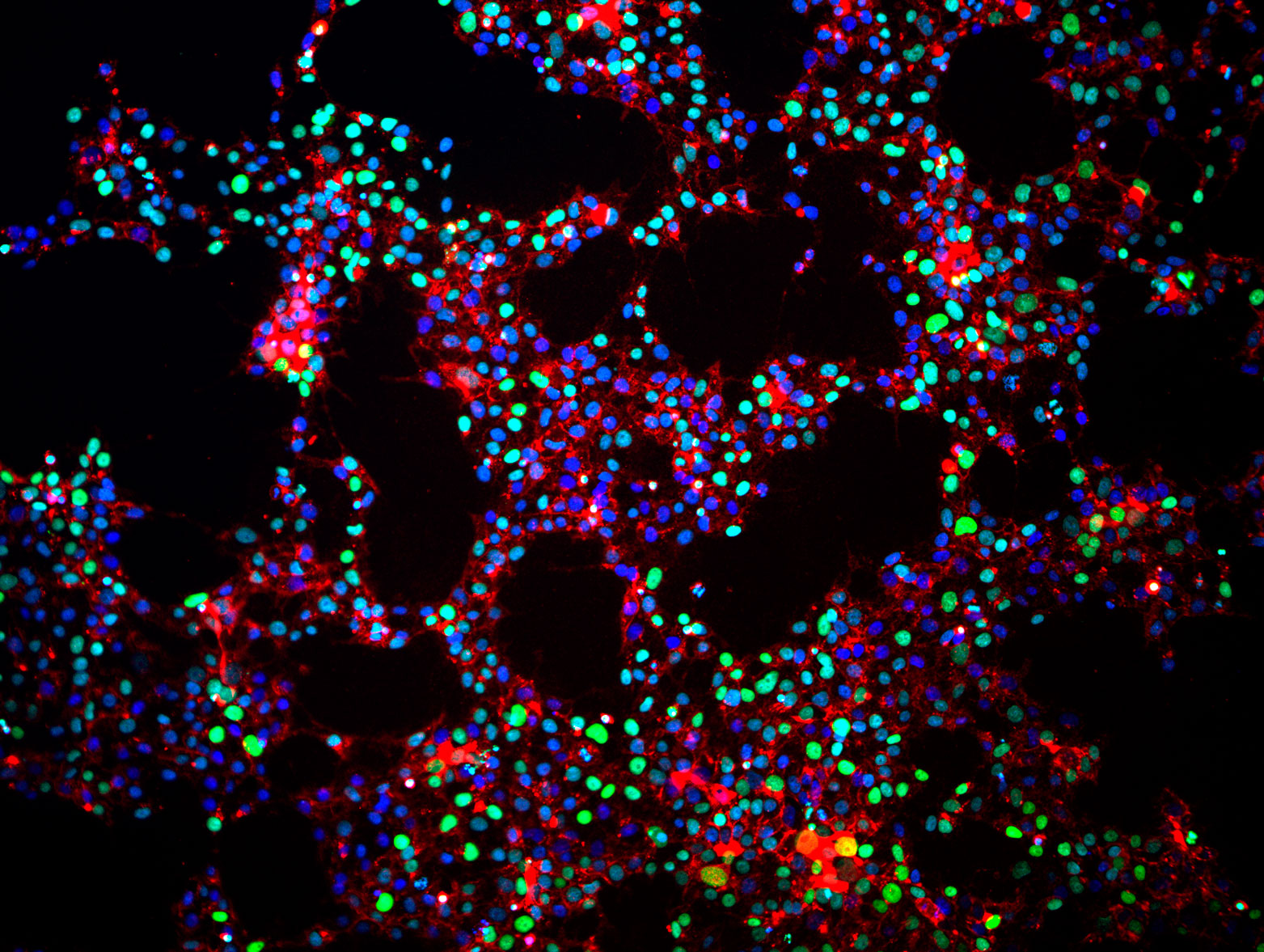 Human induced pluripotent stem cells