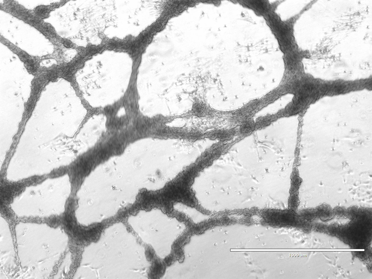 Cardiomyocytes