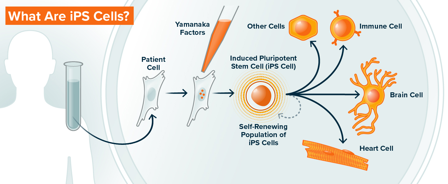 What are IPS cells graphic