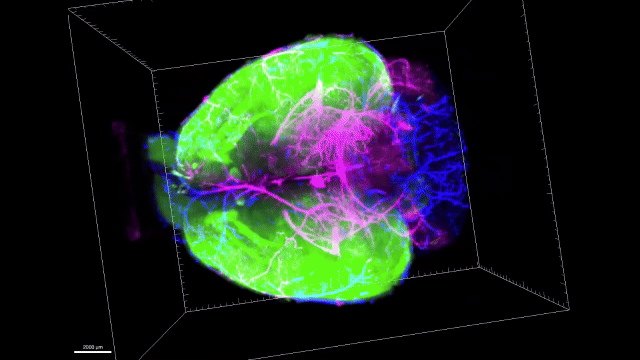 three-dimensional view of a transparent mouse brain