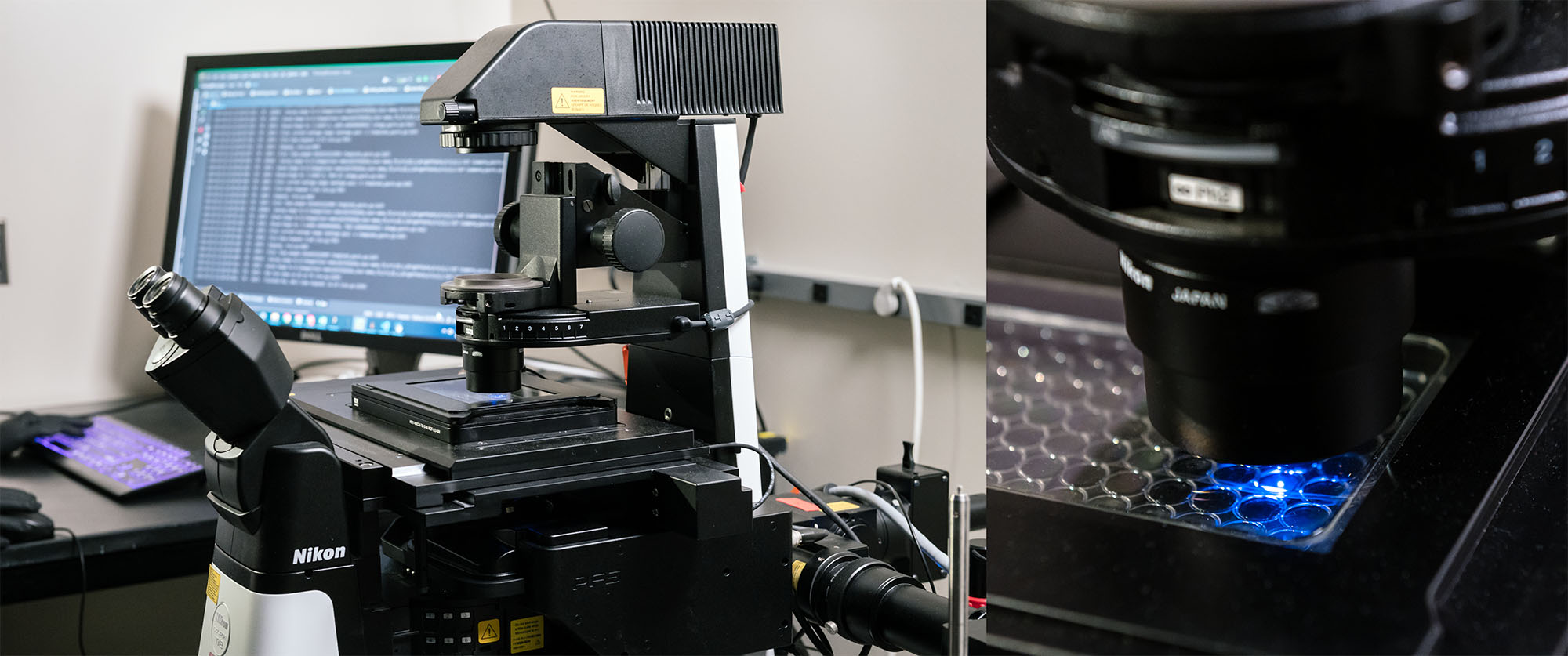 The thinking microscope invented by scientists at Gladstone Institutes.