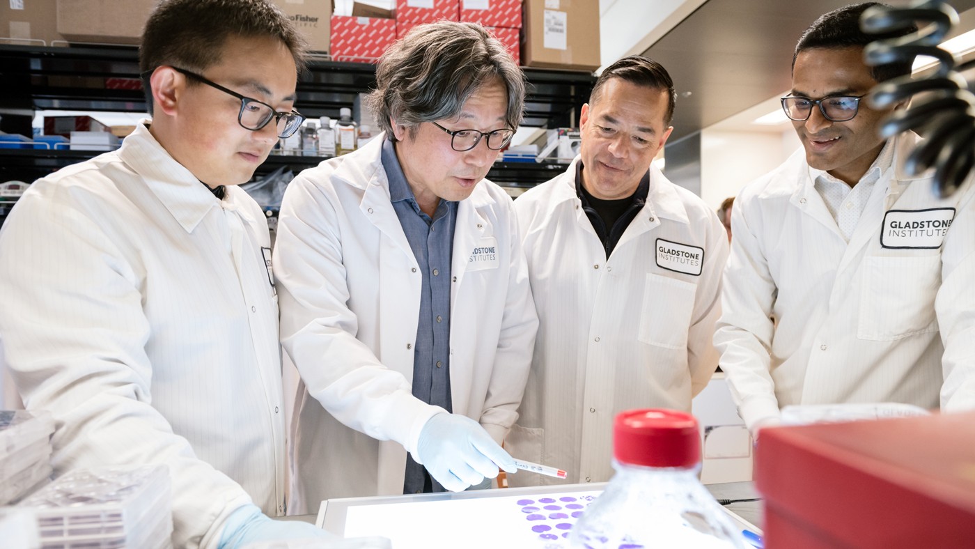  Gladstone scientists Zhaoqi Yan, Jae Ryu, Mauricio Montano, and Rahul Suryawanshi, who are are among the first authors of the new study in Nature.