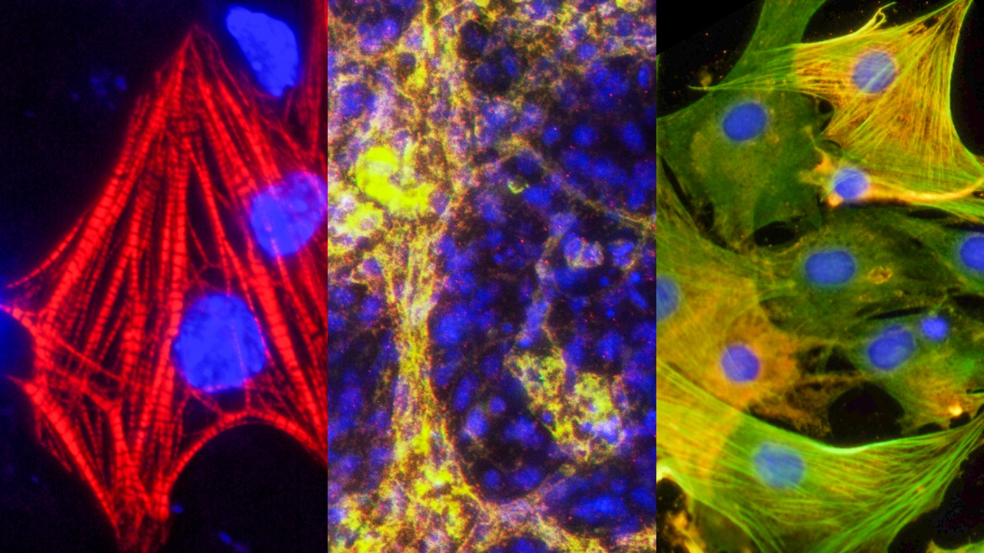 Heart cells created from ieCPCs Heart cells created from ieCPCs