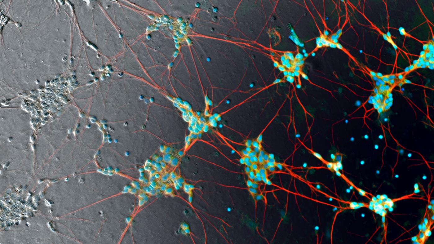 Human induced pluripotent stem cell neurons, Steve Finkbeiner/Google Human induced pluripotent stem cell neurons, Steve Finkbeiner/Google