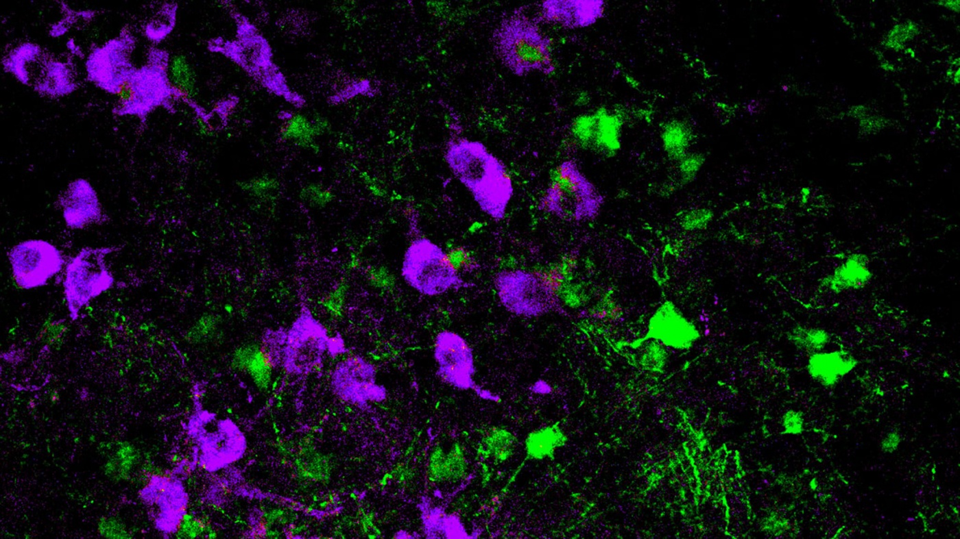 Neurons in the brainstem
