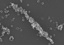 Semen fibril laced with HIV virus