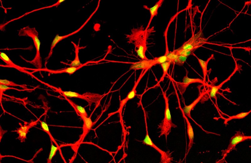 Human inhibitory neurons composite image