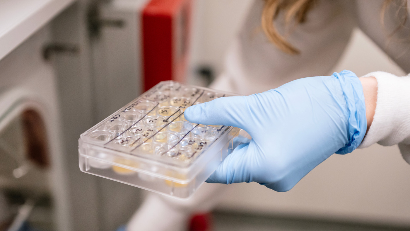 Alex Marson of Gladstone and his collaborators at Stanford University developed a genomic mapping technique that helps close the gap in understanding why certain genetic variants are tied to disease.