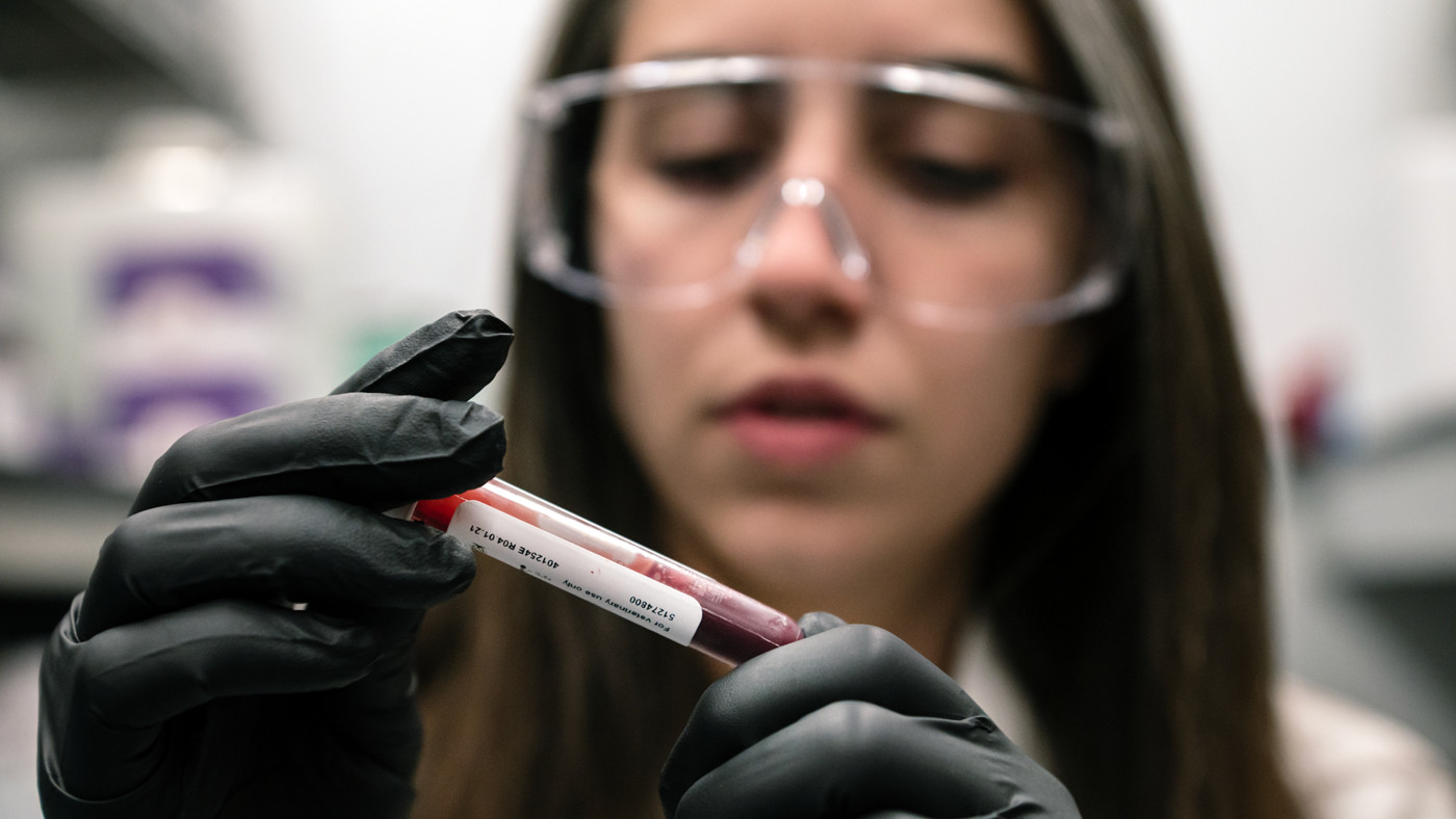 Yolanda Martí-Mateos in the lab at Gladstone Institutes