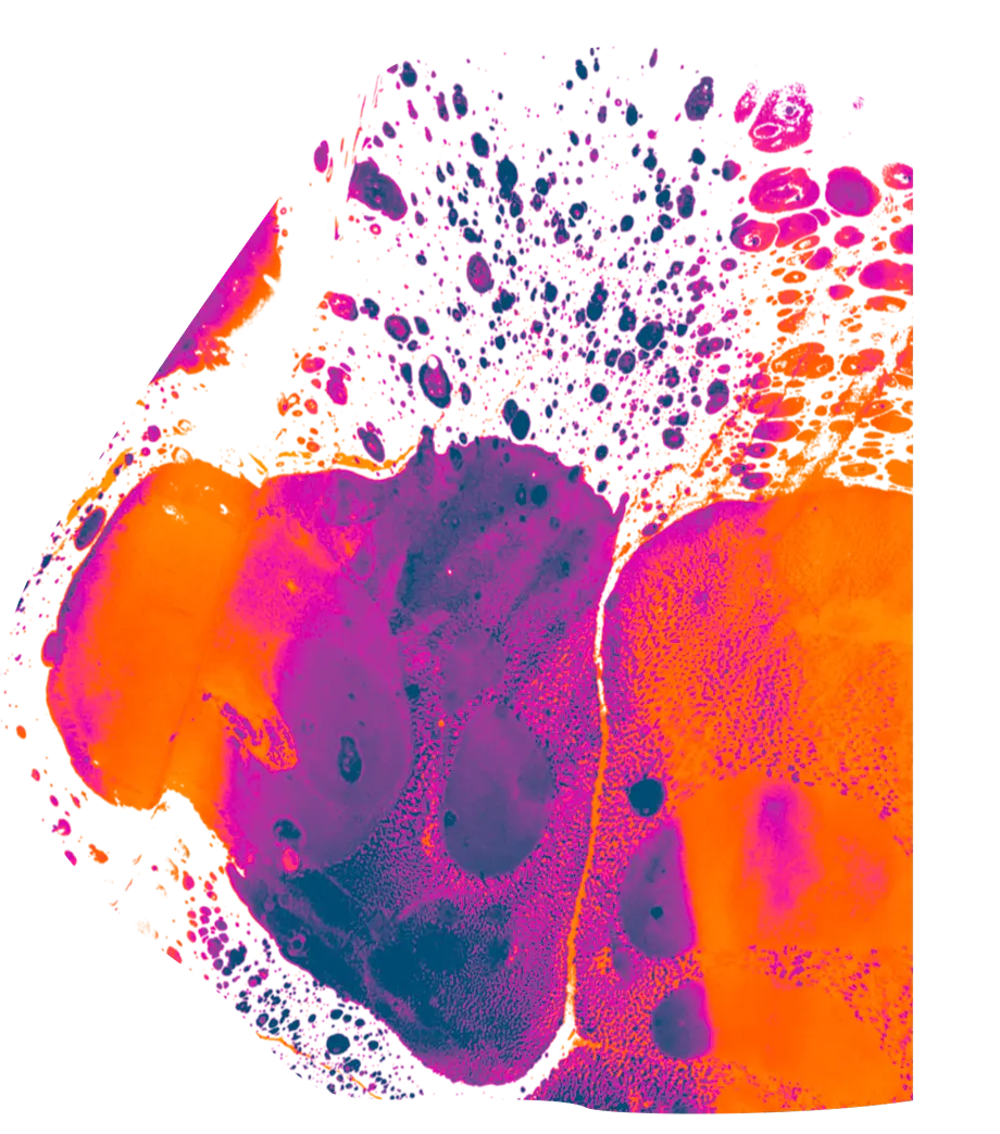 Floating Chromosome