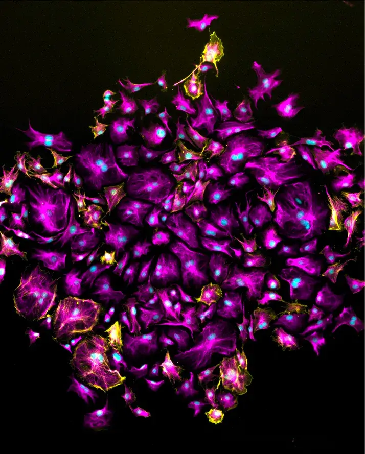 CRISPR Genome Editing