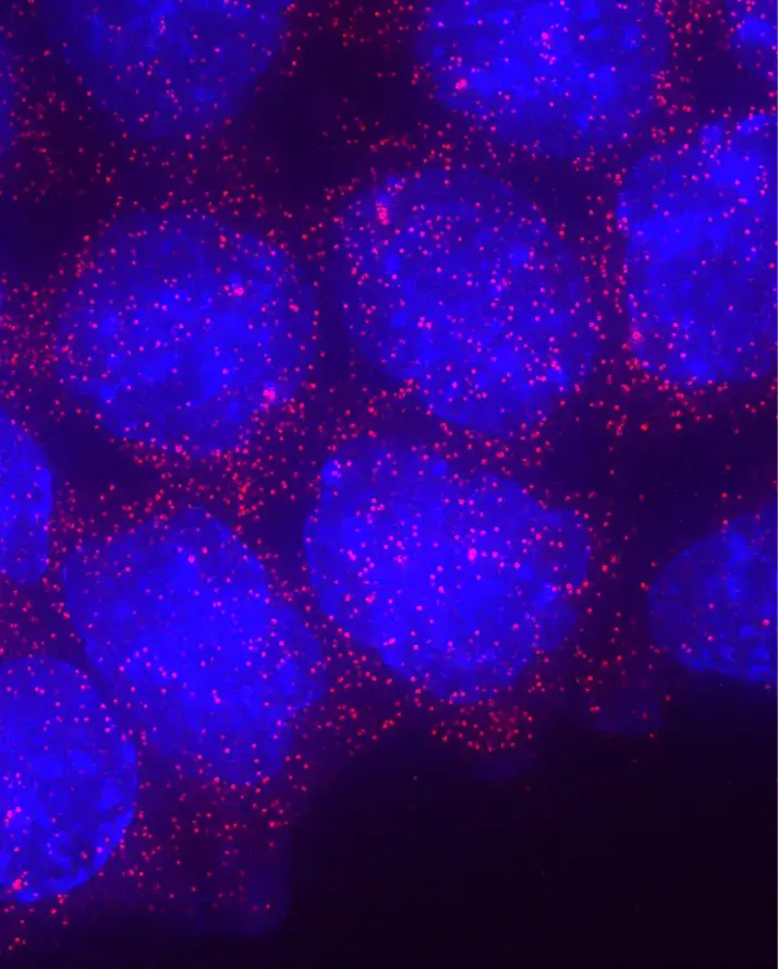 Phage Therapy