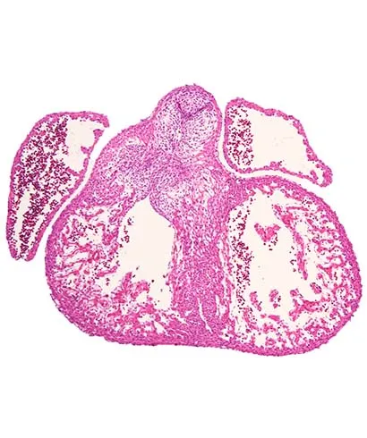 Scientific image of an Aortic Valve