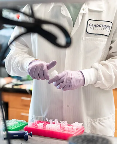 A researcher in a lab coat prepares samples for analysis related to Autoimmune Disease at Gladstone Institutes.