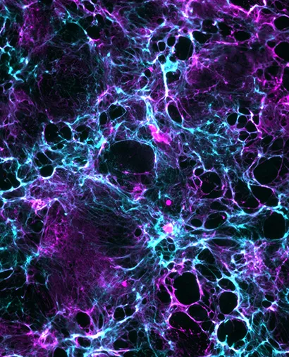 Mouse cardiac cell derived ECM