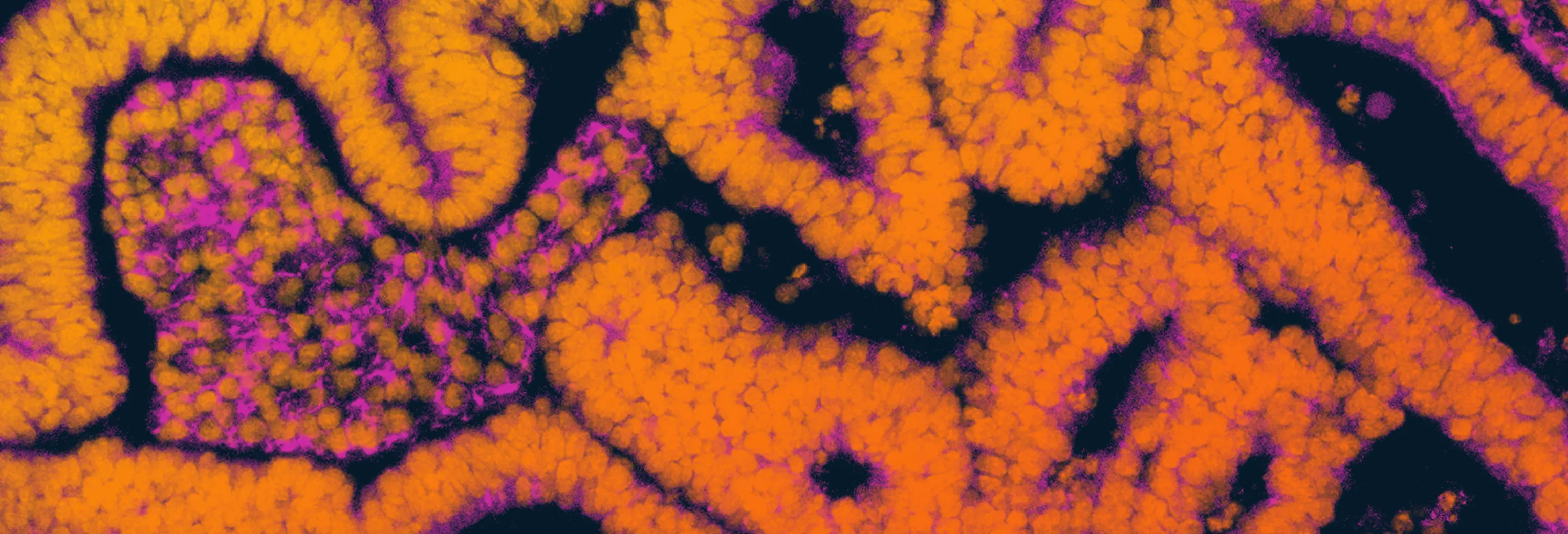 Disease Banner Image