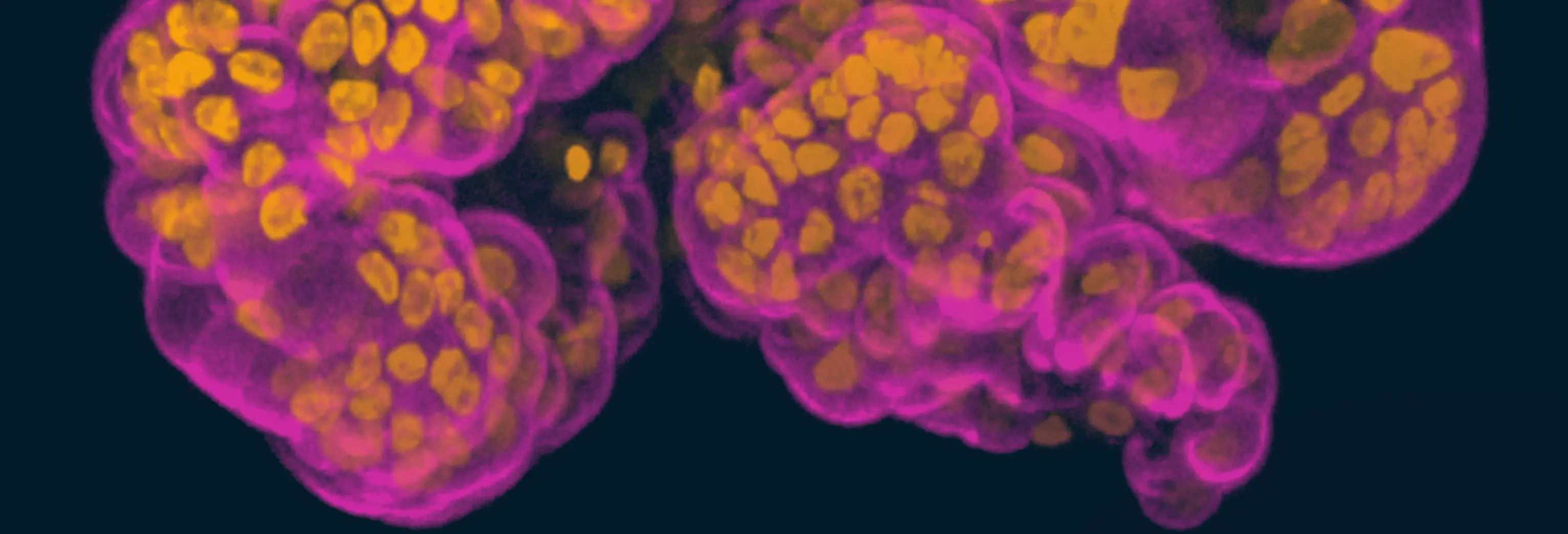 Disease Banner Image