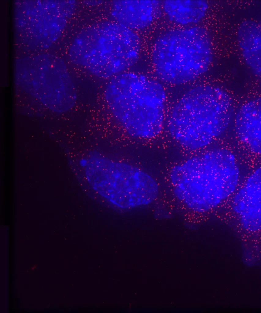 Phage Therapy