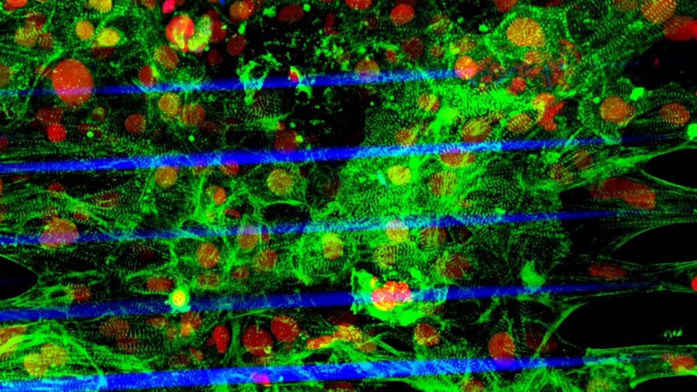 Image of the human stem cell–derived cardiac microtissue grown on a fiber-based scaffold fabricated using a laser-guided bioprinting technology