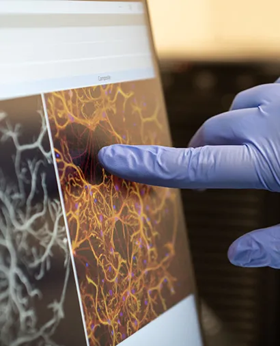 Identified New Functions of Tau and Ways to Block Its Adverse Effects on the Brain