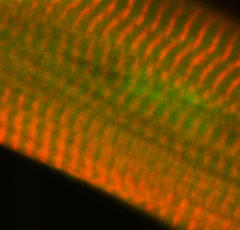 Reprogrammed Heart Cell