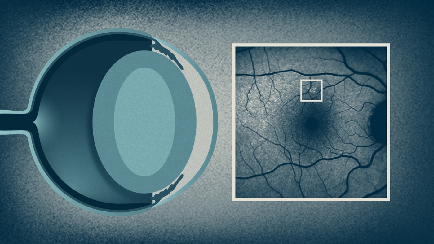 Feature image