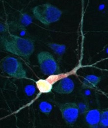 Brain cell with TDP43 and hUPF1 highlighted