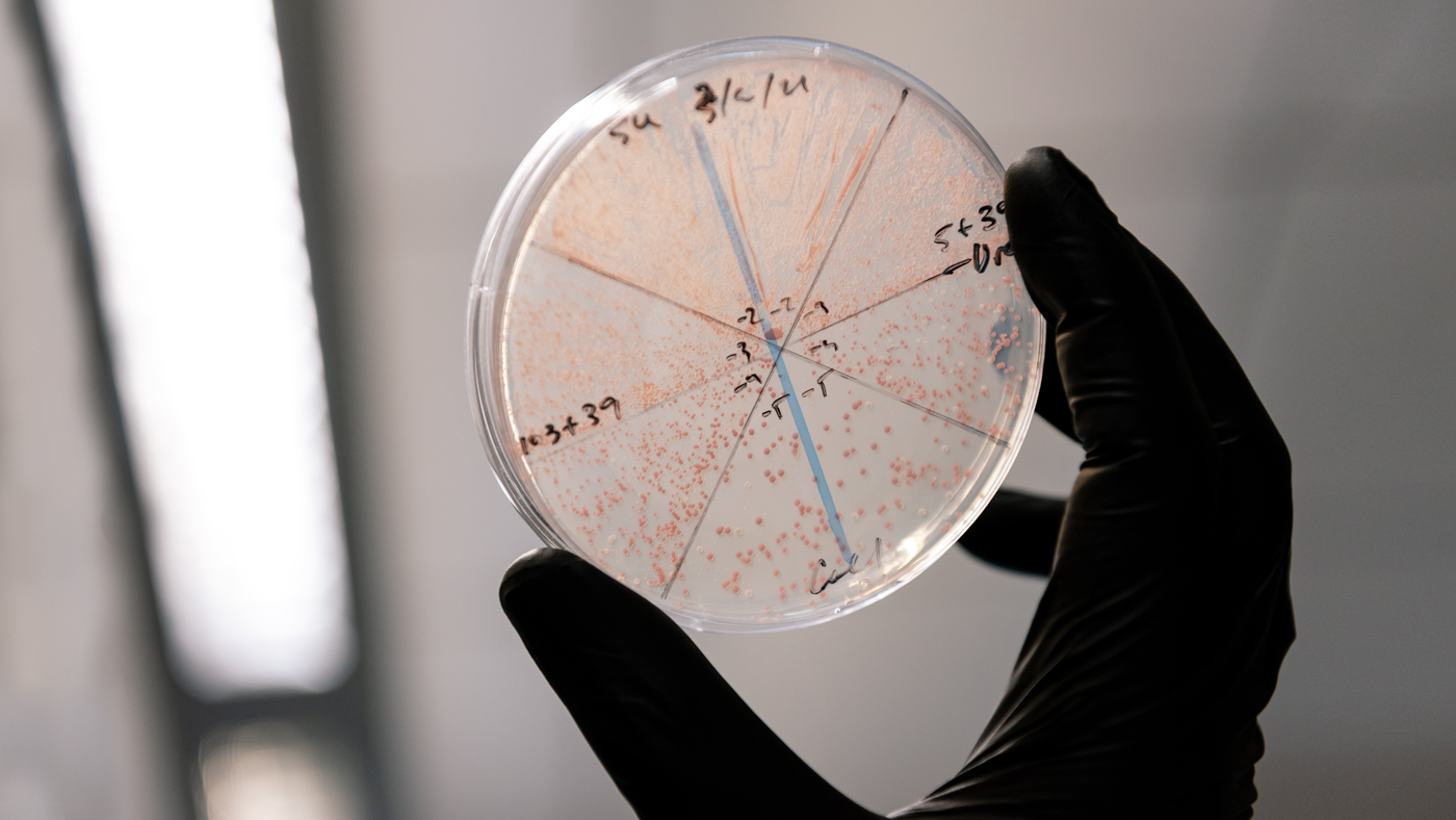 Yeast plate from the Shipman Lab at Gladstone
