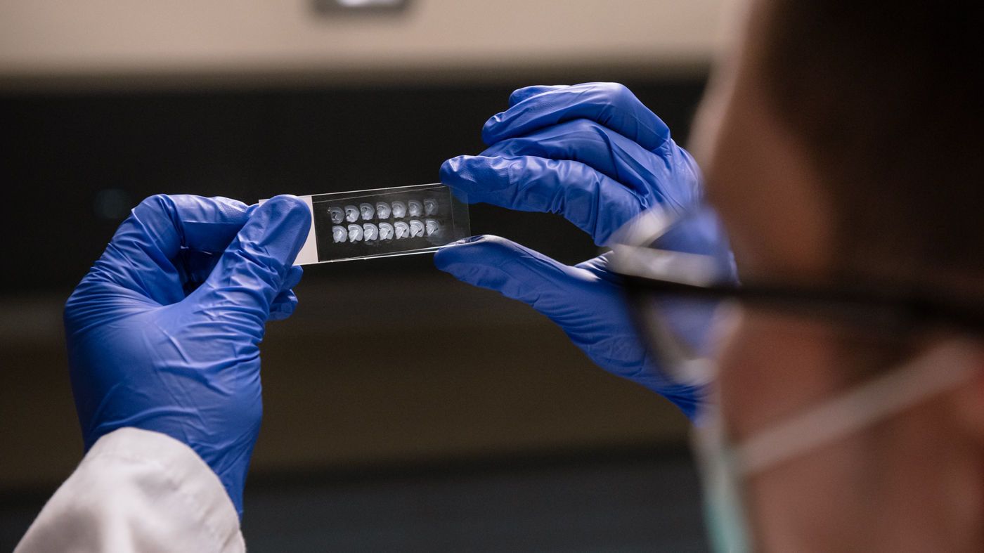 A postdoc works on mounting slides in the Mucke Lab at Gladstone.