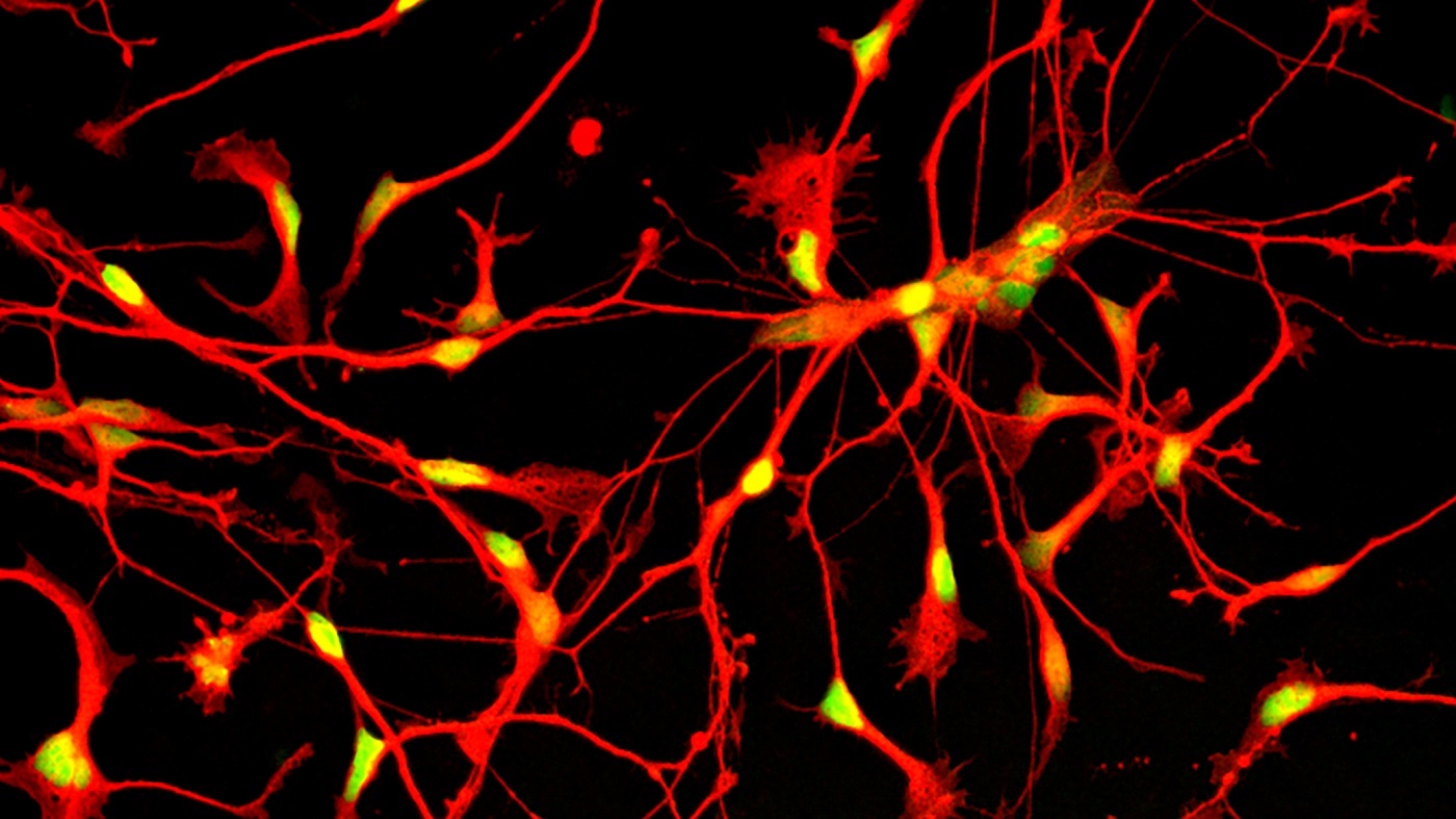 Human inhibitory neurons composite image