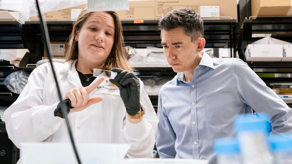 Overworked Brain Cells May Burn Out in Parkinson’s Disease