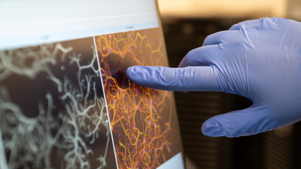 Inside the Brain: Tackling Neurological Disease at Its Roots