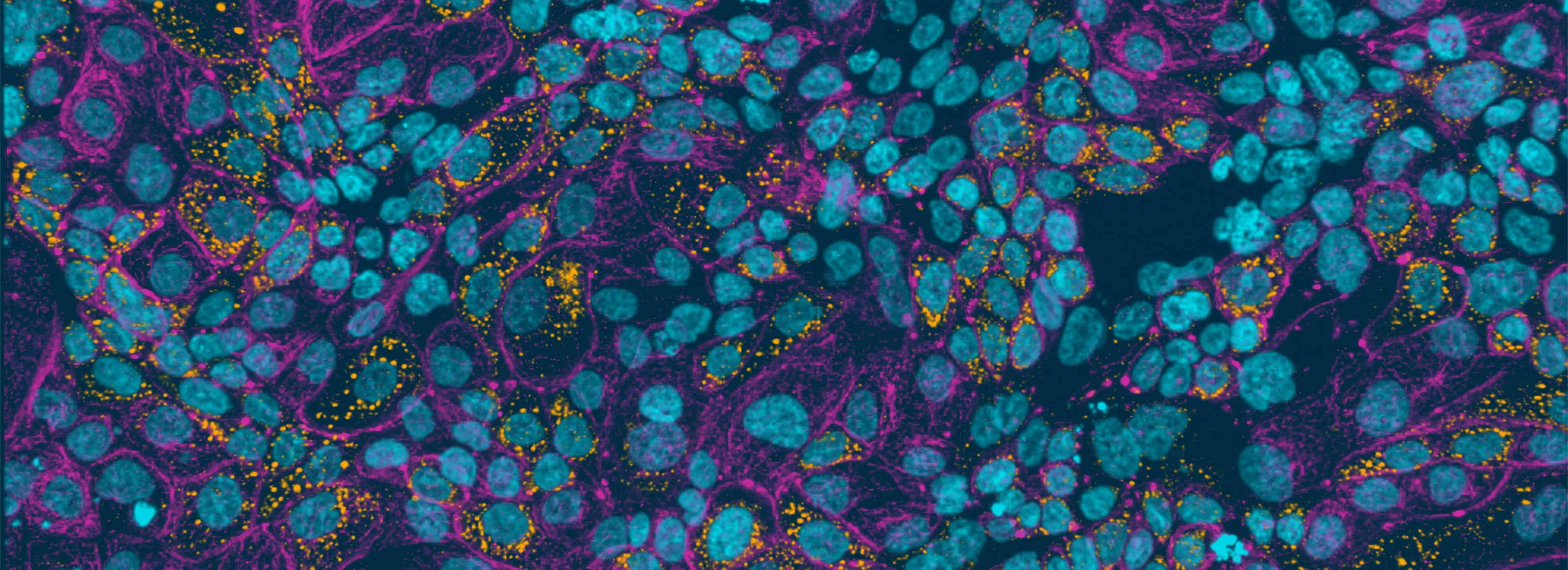 Disease Banner Image