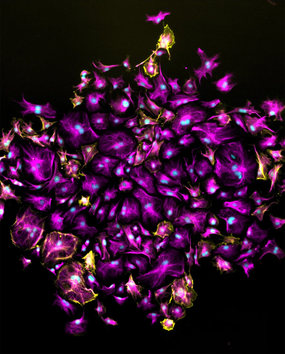 CRISPR