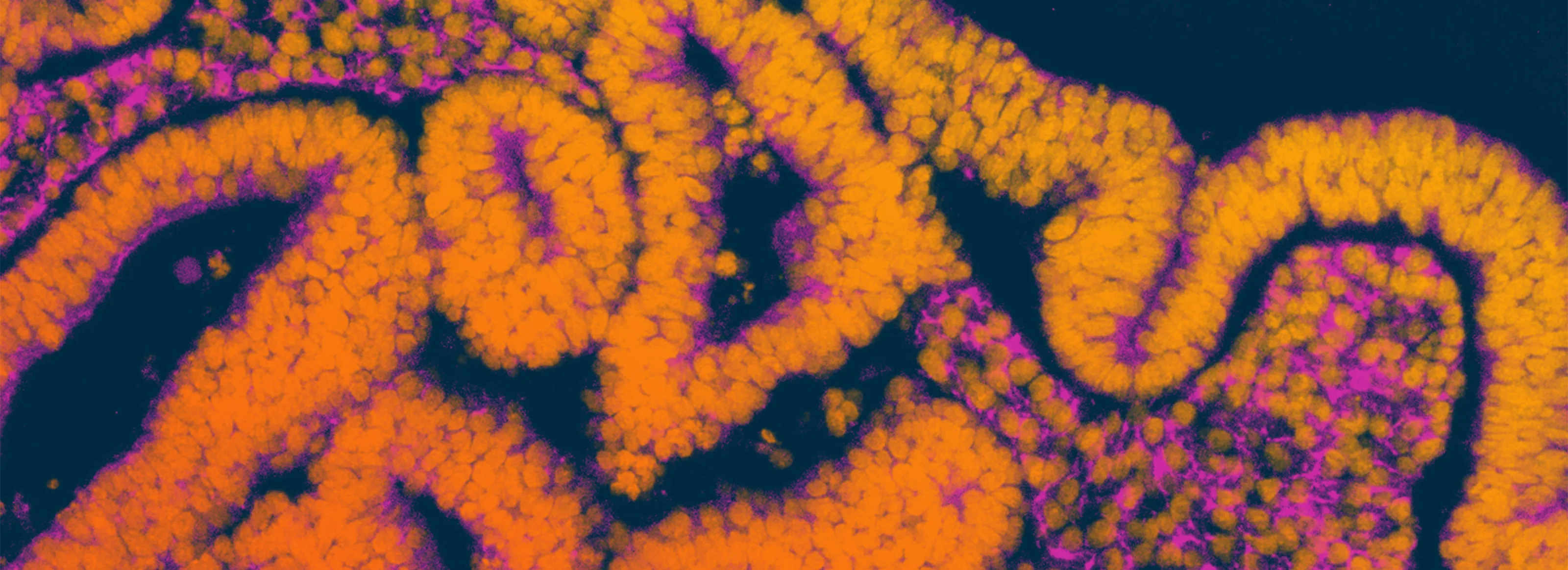 Disease Banner Image