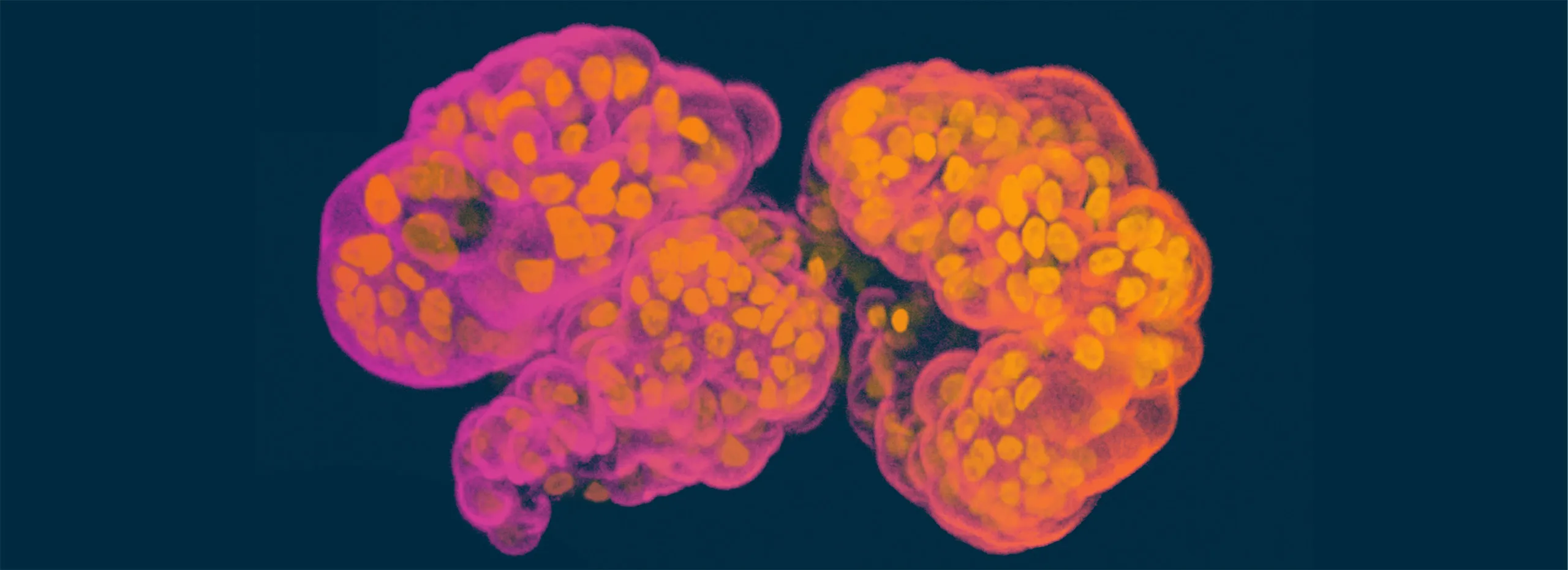 Disease Banner Image