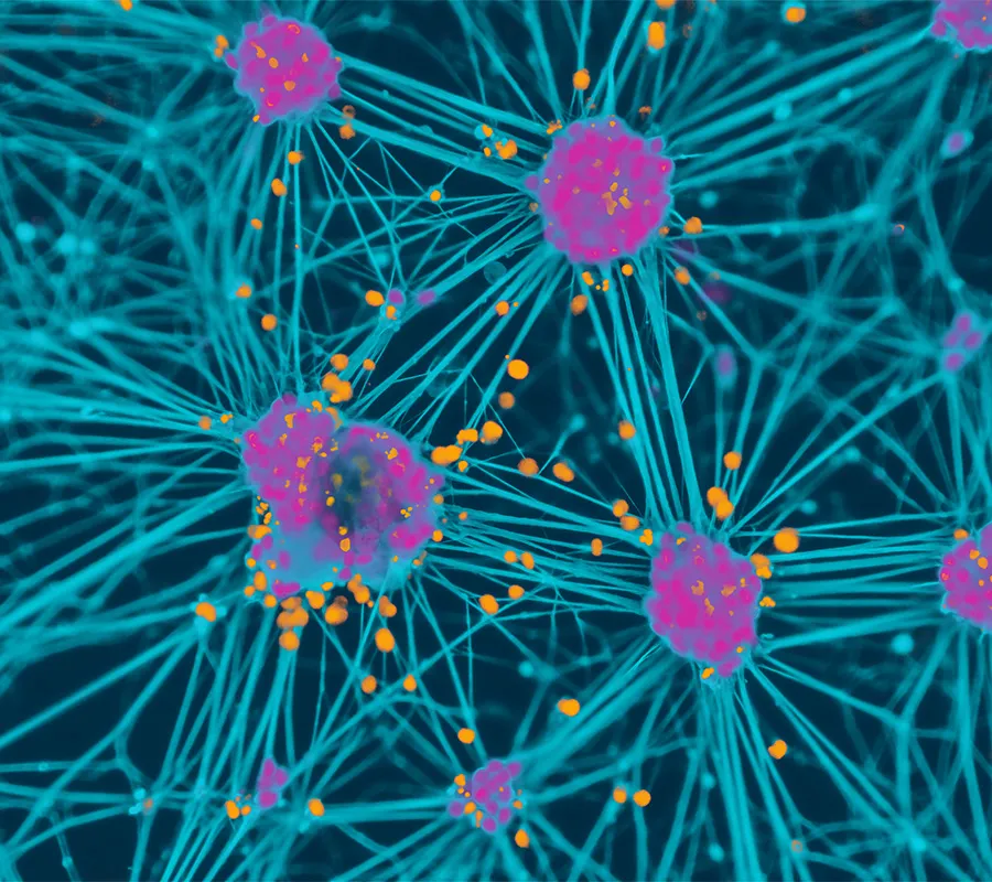 Parkinson’s Disease