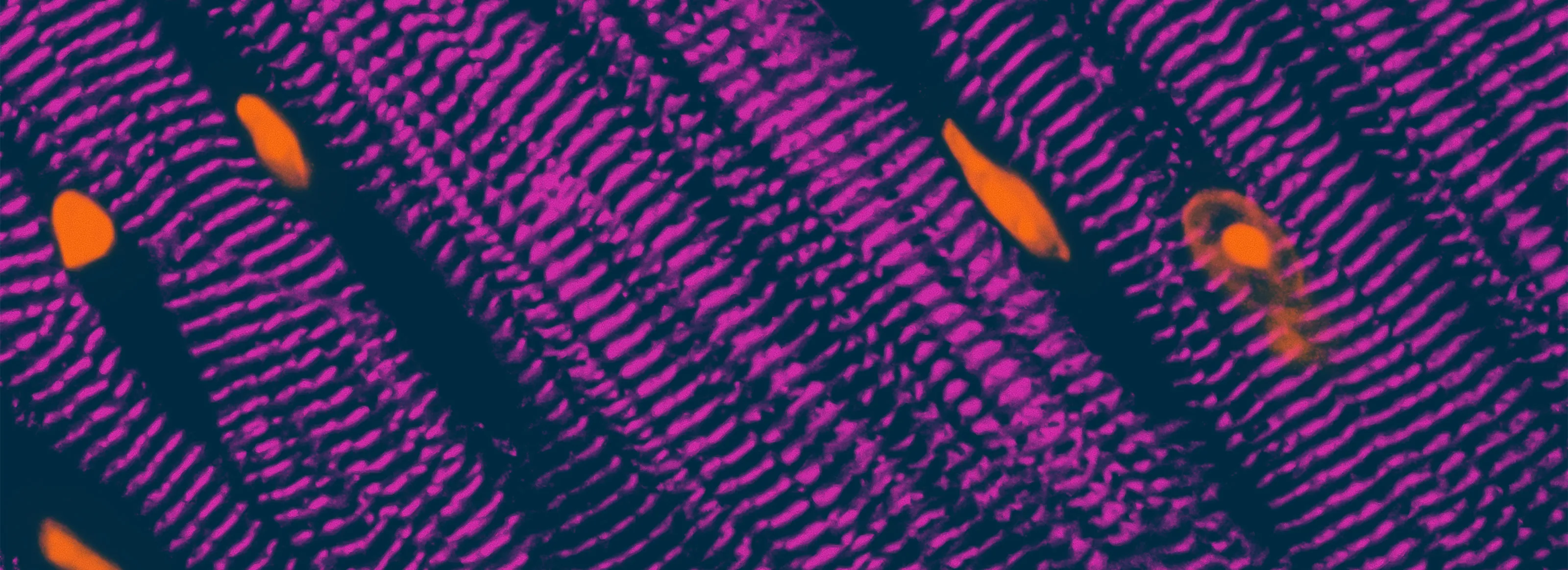 Disease Banner Image
