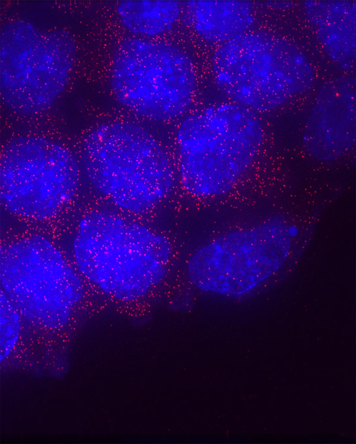Phage Therapy