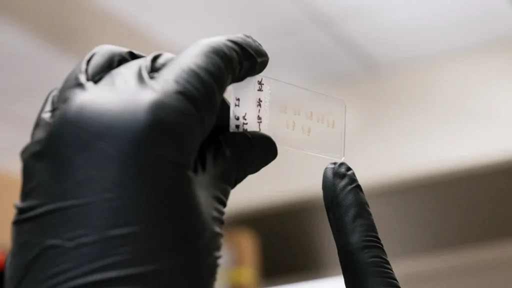 In Alzheimer’s Disease, the Brain’s Pacemaker Cells Lose Their Beat